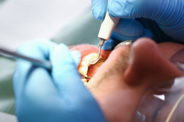 Best Same-Day Emergency Dental Services in Hurt, VA
