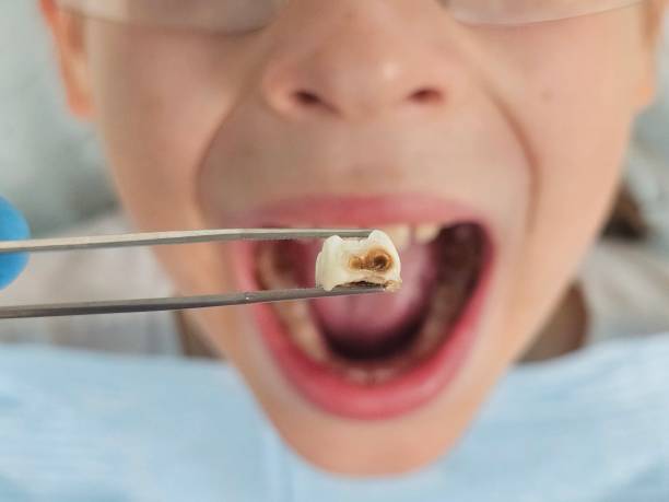 Best After-Hours Dental Trauma Care in Hurt, VA