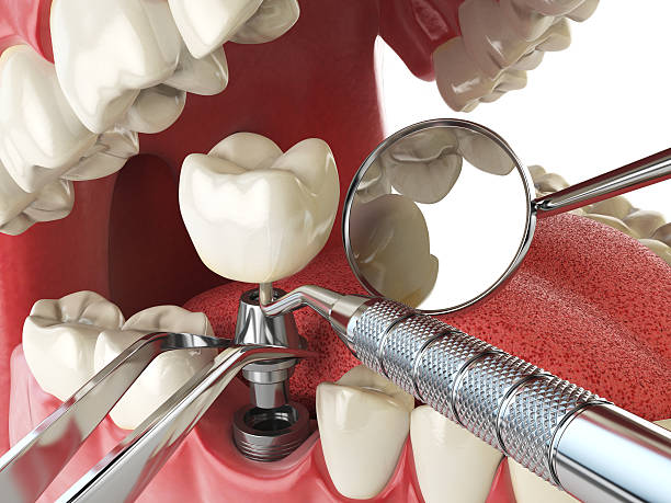 Best Same-Day Emergency Dental Services in Hurt, VA